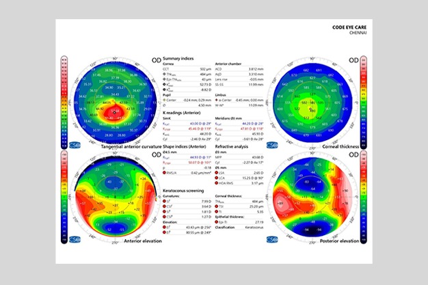 State of Art Equipment - screenings 5 KERATOCONUS page 0001 1536x1187 1