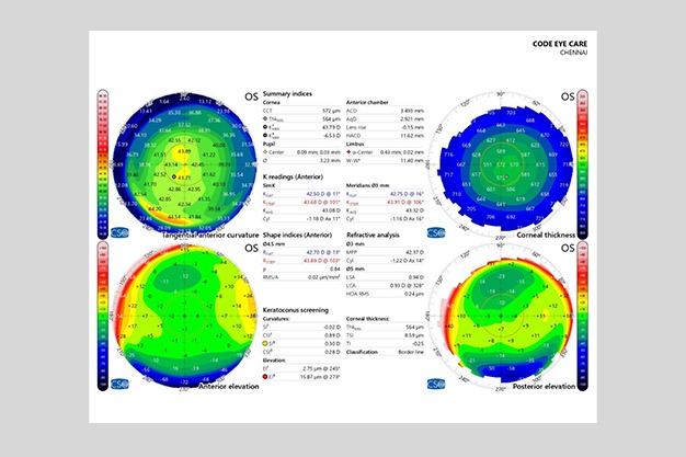 State of Art Equipment - screenings 4 REFRACTIVE SURGERY page 0001 1536x1187 1