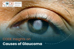 What Causes Glaucoma