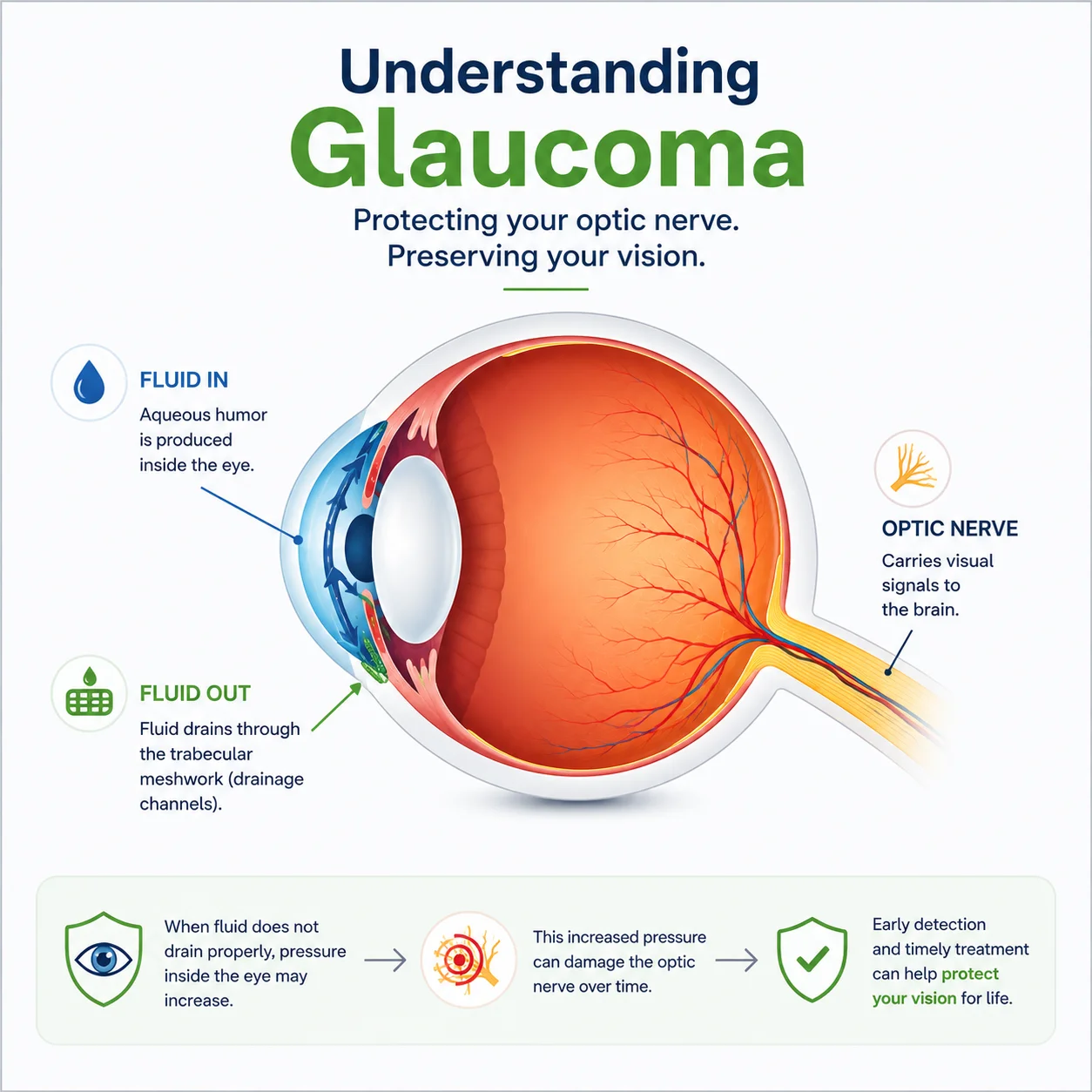 understanding glaucoma