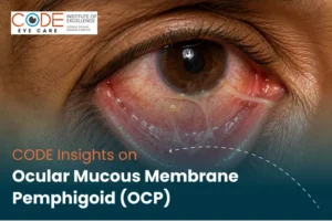 CODE Insights on ocular mucous membrane pemphigoid